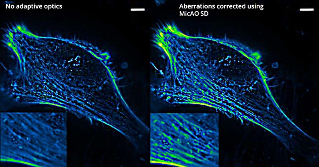 Imagine Optic Confocal and Spinning Disk Microscopy For Live Cell Imaging