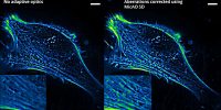 Imagine Optic Confocal and Spinning Disk Microscopy For Live Cell Imaging