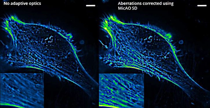 Use of Adaptive Optics in Microscopy | SphereOptics
